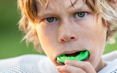 Individualized and Mouthformed (boil-and-bite)
Mouthguards: Comparative Analysis on a Soccer Team