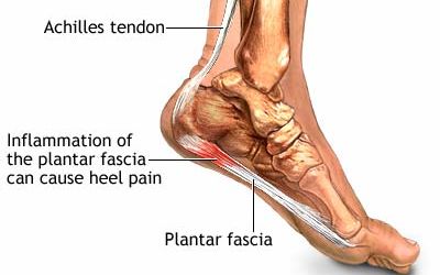 Rehabilitation of Plantaris Tendon Rupture in an Elite Triathlete: A Case Report