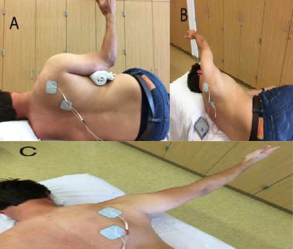 The Effect of Electrical Stimulation Cueing in a Competitive Powerlifter with Shoulder Pain and Scapular Dyskinesis: A Case Study