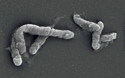 The Microorganism Acidithiobacillus ferrooxidans can use Electrical Current as a Direct and Sole Energy Source