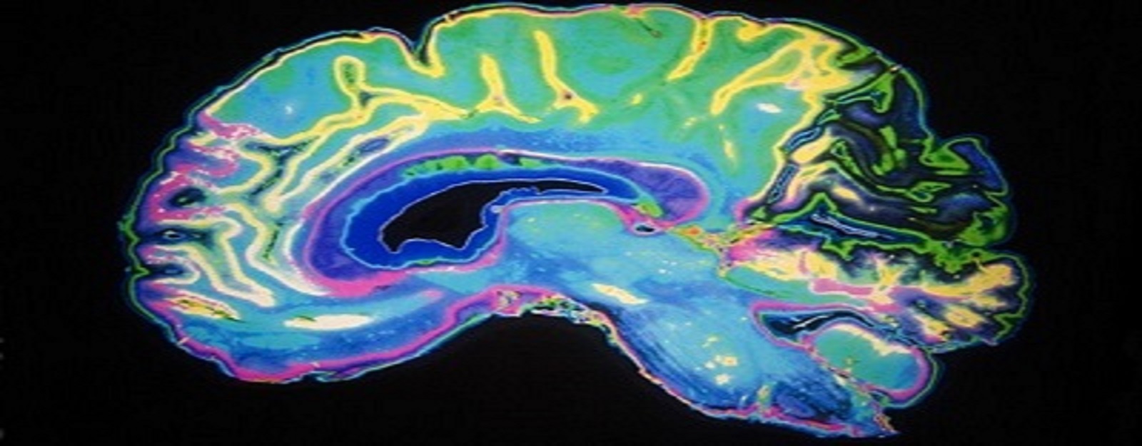Can Renalase Enzyme Control the Fate of Parkinson’s and Schizophrenia?