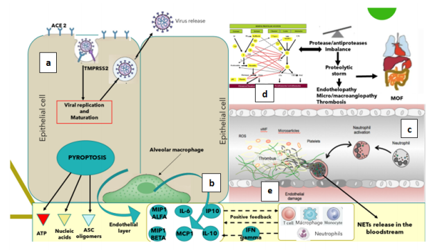 COVID-19: Neutrophils
“Unfriendly Fire” Imbalances
Proteolytic Cascades Triggering
Clinical Worsening and Viral
Sepsis. Potential Role Explanation
for Convalescent Plasma as
“Firehose”