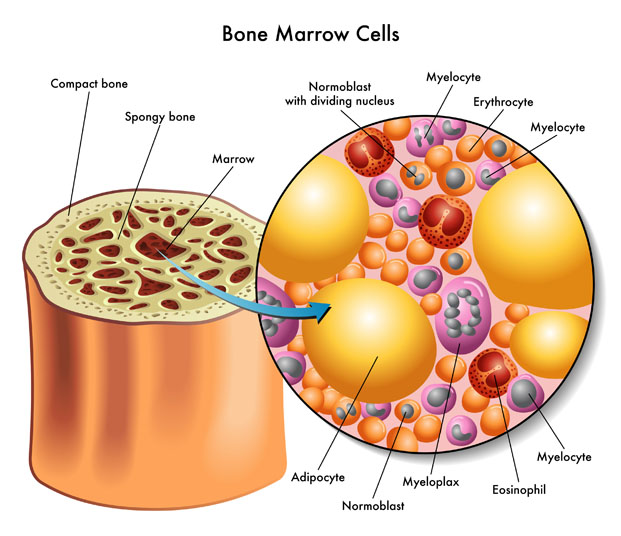 Prologue to a How I Treat 
Arrangement on Significant 
Complexities after Allogeneic Undifferentiated Cell Transplantation