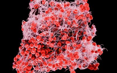 The Role of Wnt/β -Catenin Signaling in Normal and Malignant Hematopoiesis, Hemostasis