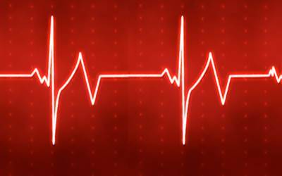 A Cardiac SPECT System with Multiple Collimated Detectors Rotating in an Elliptical Orbit