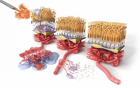 Antiangiogenic Activity of rTRAIL is Potentiated by Sflt-1, a VEGF Trap