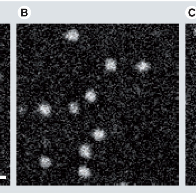 Annular Dark Field Transmission Electron Microscopy for Protein Structure Determination