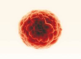 Cancer Stem cells in Prostate Cancer Radioresistance