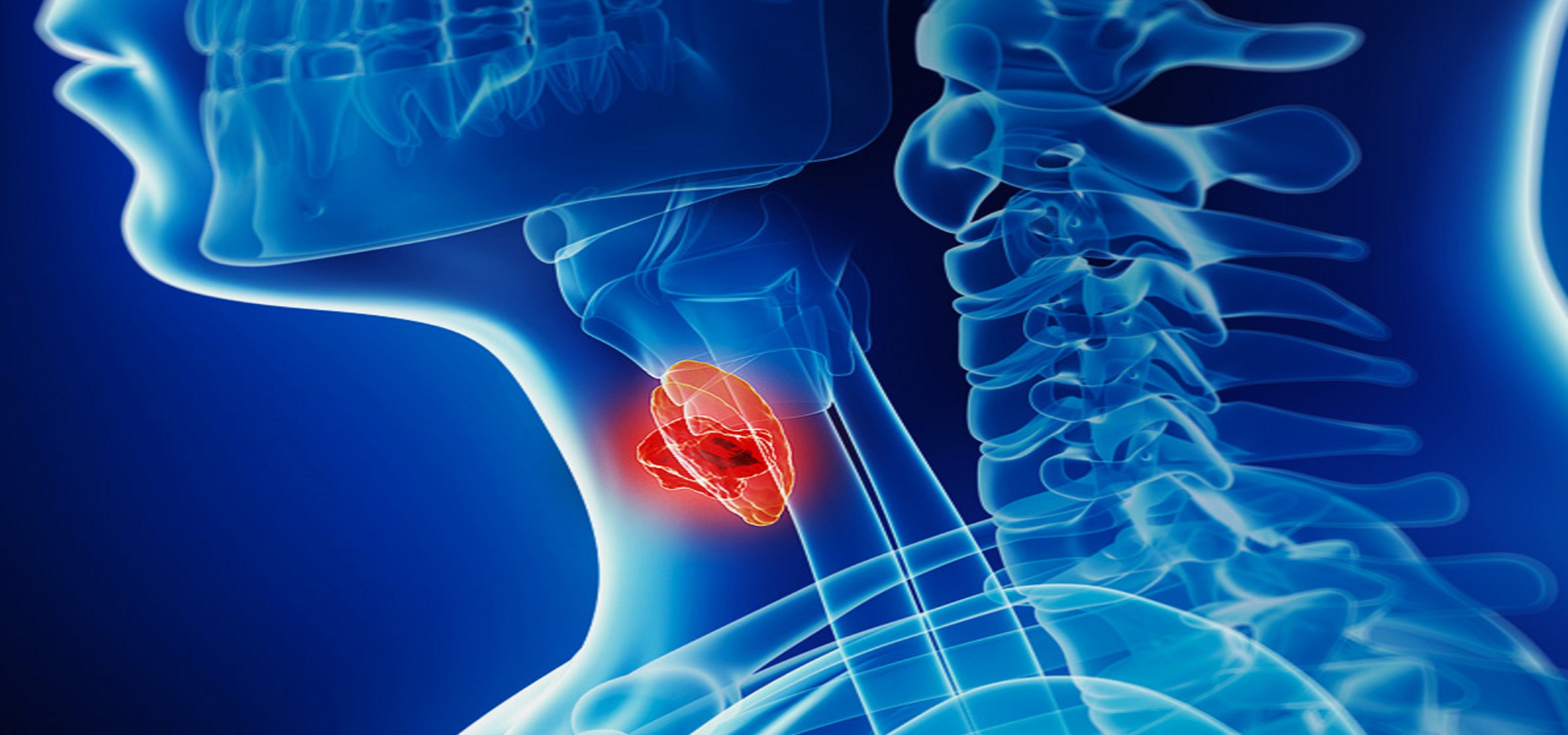 Oncology haema