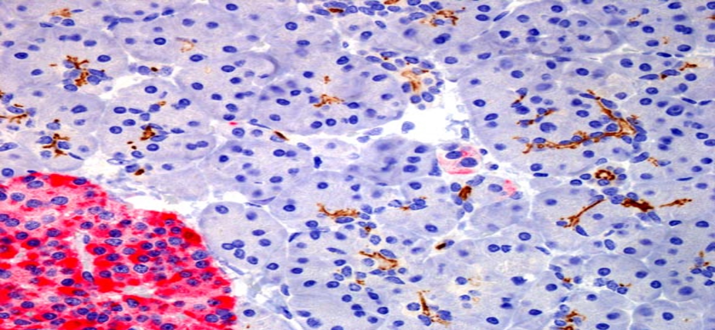 Single Versus Double Ring Structure: Search for Best Anti-Neoplastic Driver in Colon and Pancreatic Cancer Cells-Taurultam or Taurolidine?