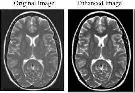 Medical Image Enhancement with Preserved Detail and Brightness