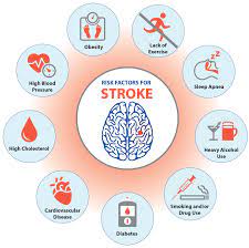 Link between Statin Adherence and the Risk of Stroke
