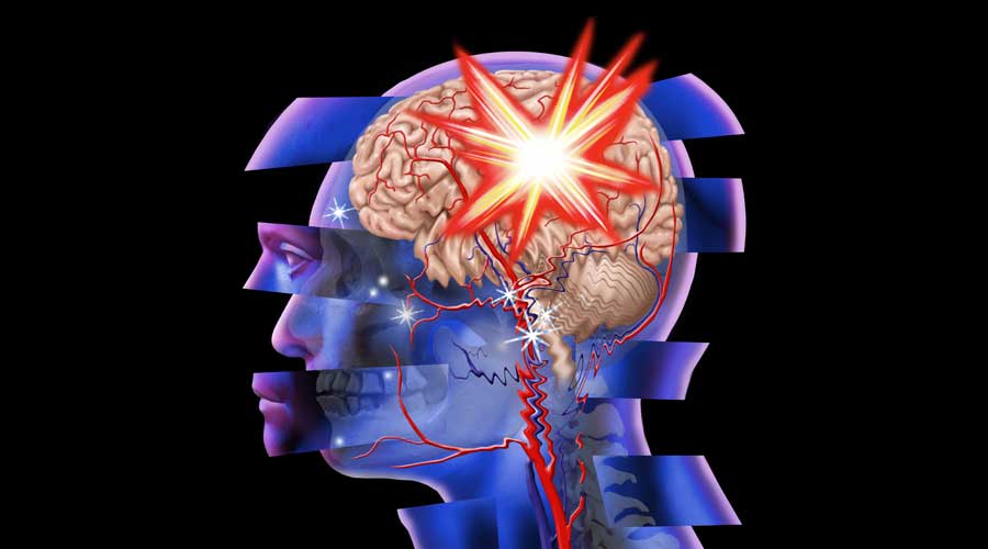 Traumatic Brain Injury and Branched-Chain Amino Acids