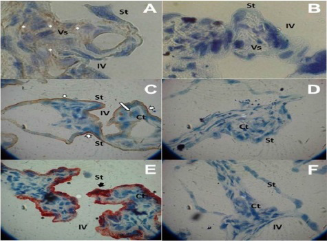 Transferrin Receptor 1 and Ferroportin Expression in the Full-Term Human Placenta and its Association with Maternal and Neonatal Iron Status: A Pilot Study