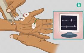 Electromyography Study of the Contraction of the Scalene and Rectus Abdominis during the Respiratory Cycle in Healthy Subjects