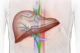 Protein-Losing Enteropathy/Intestinal Lymphangiectasia