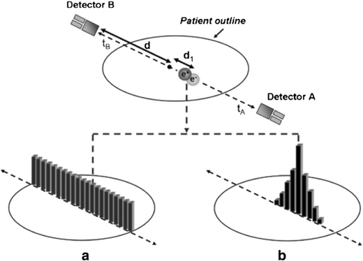 Positron Discharge Tomography Output Can Frequently Identify the Problems