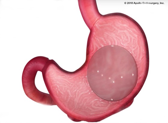 Remarkable Point Of View of Muslim Patients on Sexual Orientation Inclination for GI Endoscopists: A Multicenter Study