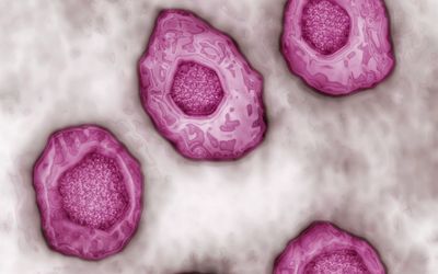 Incidence of Infectious Mononucleosis in Universities and U.S. Military Settings