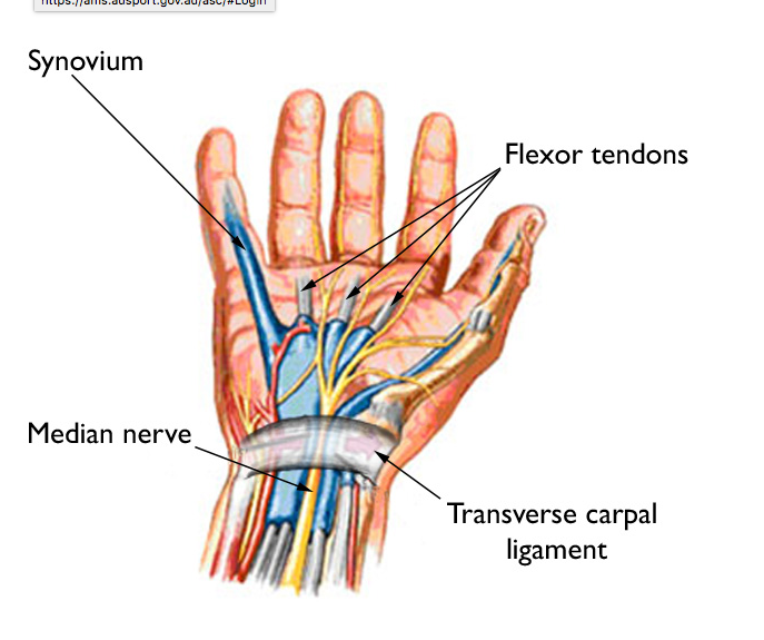 Work Related Disorders