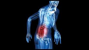 Work-Related Musculoskeletal Disorders & Ergonomics