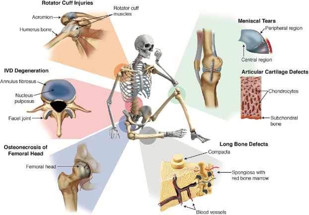 Current Advances and Novel Research on Minimal Invasive Techniques for Musculoskeletal Disorders