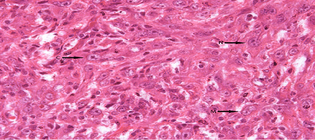 The Mammary Gland Carcinogens: The Role of Metal Compounds and Organic Solvents