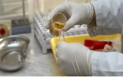 Screening of Urine and Blood Using Limited Sample Preparation and Information Dependent Acquisition with LC-MS/MS as Alternative for Immunoassays in Forensic Toxicology
