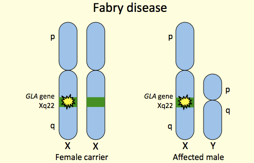 Treatment with Agalsidase Alfa during Pregnancy in a Heterozygous Female with Fabry Disease