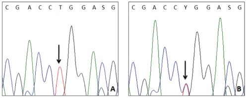 Screening of Genetic Mutations in GBA1, GIGYF2 and VPS35 in Parkinson Disease Patients from India