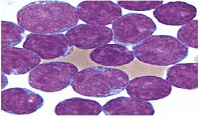 Lymphoblastic Cell Lines