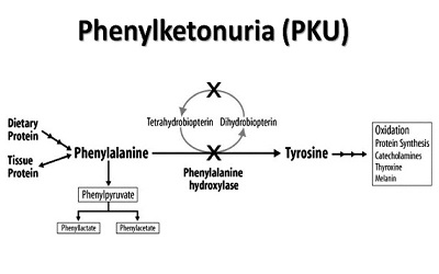 Phenylketonuria (PKU) - What Next? Mini-Review