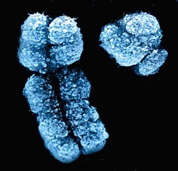 History Versus Limits of Science: Is Solomonic Genius a Y Chromosome Phenomenon?