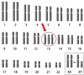 Maternal and Paternal Age at Pregnancy for Low Incidence Trisomy Groups: Preliminary Findings and Implications