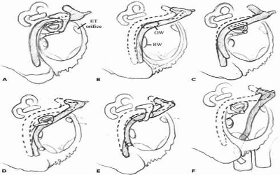 Severe Expressive-Language Delay and Congenital Malformations in a Boy with Microduplication 7q11.23 Diagnosed by Molecular Cytogenetic Analysis