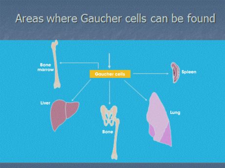 Mutational Analysis in Gaucher Disease: Implications in Genetic Counseling and Management.