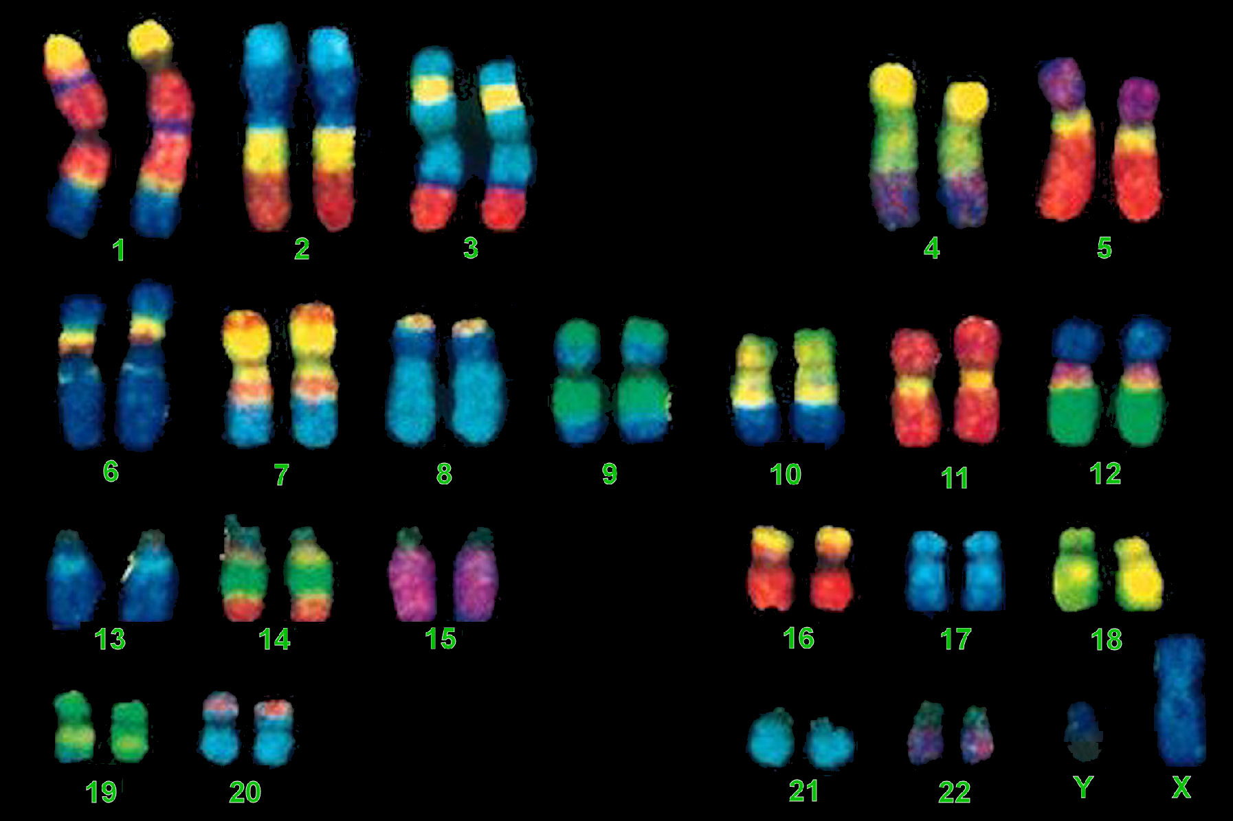 The Interpretation of Genetic Data - Considering the Effect of Changes to Gene Conformation - If the Facts Donâ€™t Support the Theory, Change the Theory â€“ How Does This Contribute to Understanding Diabetes?