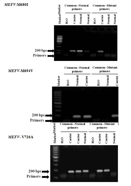 The Prevalence of Three Common MEFV Gene Mutations in West Bank Population among Students of Najah National University, Palestine