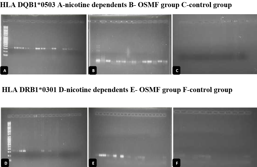 Association of HLA Typing with Nicotine Dependence by Extraction of Salivary DNA among Indian Population