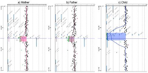 Atypical Hypotonia-Cystinuria a New Case: Genotype-Phenotype, Description