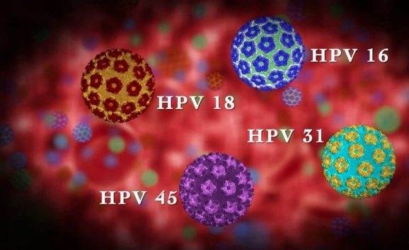 Human Papillomavirus (HPV)
Infection and Vaccines:Ottawa University Studentsâ€™ Knowledge, Awareness and Vaccine Intentions