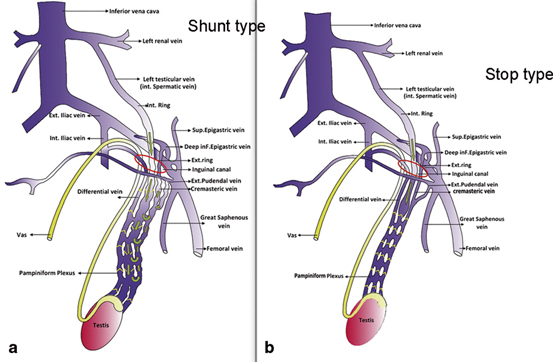 Specialists Develop New Method for Sexing Sperm