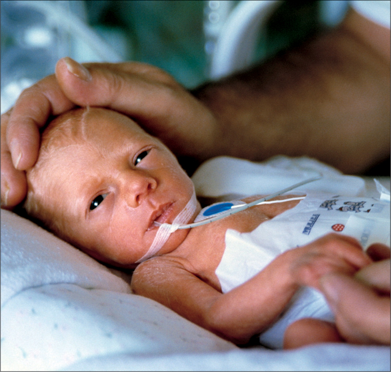 Neonatal Morbidity and Mortality by Mode of Delivery in Very Preterm Neonates