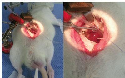 The Effect of the Antioxidant Drug U-74389G on Endosalpingeal Edema during Ischemia Reperfusion Injury in Rats