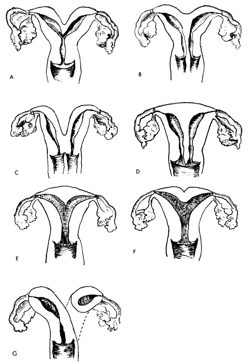 Testicular Dysgenesis Syndrome and Phthalates: Where do we Stand?