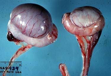 Testicular Infarction in the Presence of Epididymitis: An Anatomo Clinical Continuum?