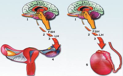 Isolated FSH Deficiency