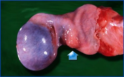 Acute Scrotum during the First Year of Life