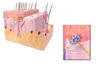 Identification of Merkel Cells in the Labia Minora Skin of Prepubertal Girls