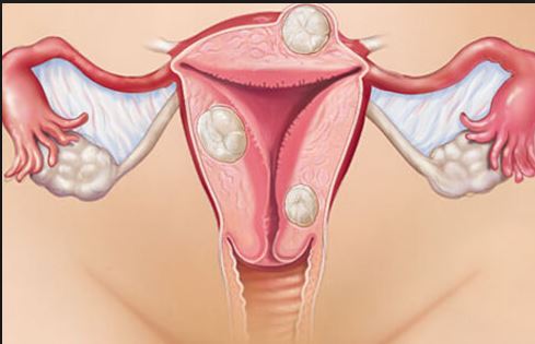 Clinical, Investigative, Postoperative Status in Cervical Precancer and Cancer